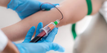 Un nuevo tratamiento contra el cáncer en el hospital de Georgetown utiliza las propias células tumorales del paciente