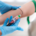 Un nuevo tratamiento contra el cáncer en el hospital de Georgetown utiliza las propias células tumorales del paciente